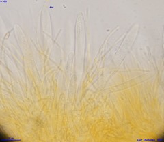 Parachnopeziza miniopsis