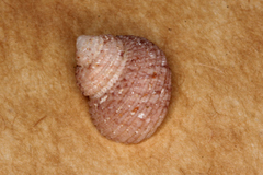 Herpetopoma