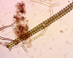 Triploceras verticillatum
