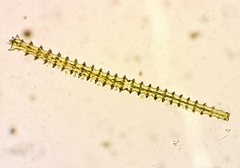 Triploceras gracile
