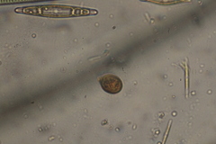 Trachelomonas similis