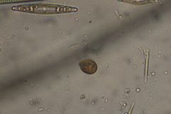 Trachelomonas similis