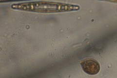 Trachelomonas similis