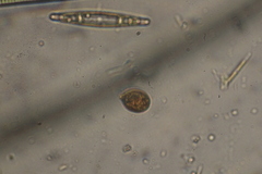 Trachelomonas similis