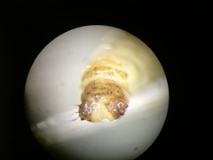 Limnephilus extricatus