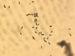 Chaenothecopsis ochroleuca