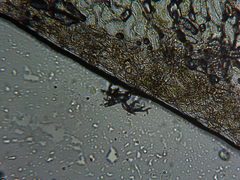 Peronospora alsinearum