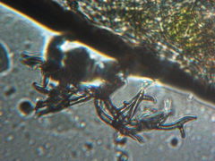 Peronospora alsinearum