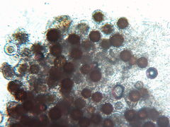 Peronospora alsinearum