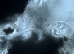 Opegrapha sphaerophoricola