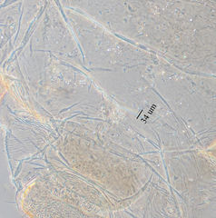 Hyperomyzus lactucae