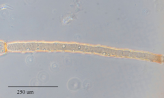 Hyperomyzus lactucae