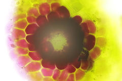 Synchytrium anemones