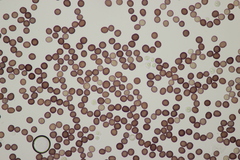 Microbotryum pustulatum