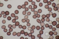 Microbotryum pustulatum