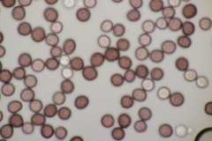 Microbotryum pustulatum