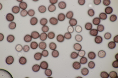 Microbotryum pustulatum