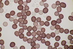 Microbotryum pustulatum