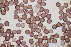 Microbotryum pustulatum