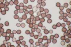 Microbotryum pustulatum