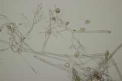 Peronospora agrestis