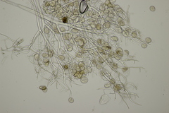 Peronospora agrestis