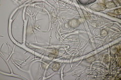 Peronospora agrestis