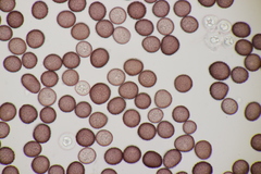 Microbotryum pustulatum