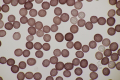 Microbotryum pustulatum