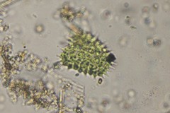 Pseudopediastrum boryanum longicorne