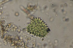 Pseudopediastrum boryanum longicorne