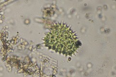 Pseudopediastrum boryanum longicorne