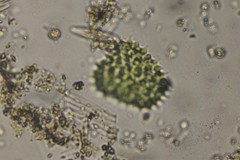 Pseudopediastrum boryanum longicorne