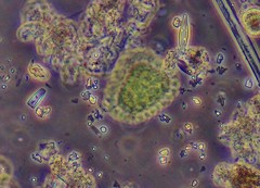 Pseudopediastrum boryanum longicorne