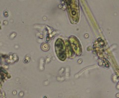 Scenedesmus