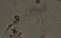 Monoraphidium contortum