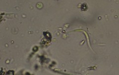 Monoraphidium contortum