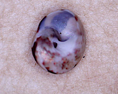 Cantharidella picturata