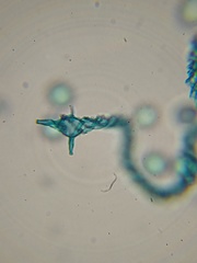 Hemitrichia leiocarpa