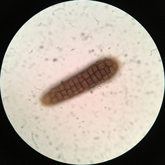 Berkleasmium concinnum