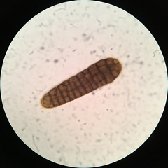 Berkleasmium concinnum