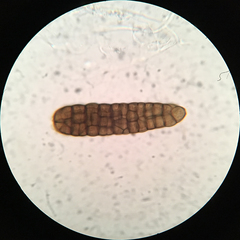 Berkleasmium concinnum