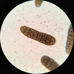 Berkleasmium concinnum