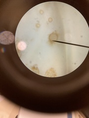 Chytridiomycota