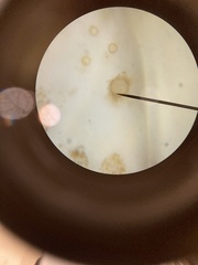 Chytridiomycota