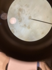 Chytridiomycota