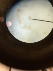 Chytridiomycota