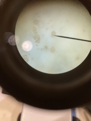 Chytridiomycota