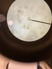 Chytridiomycota
