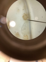 Chytridiomycota